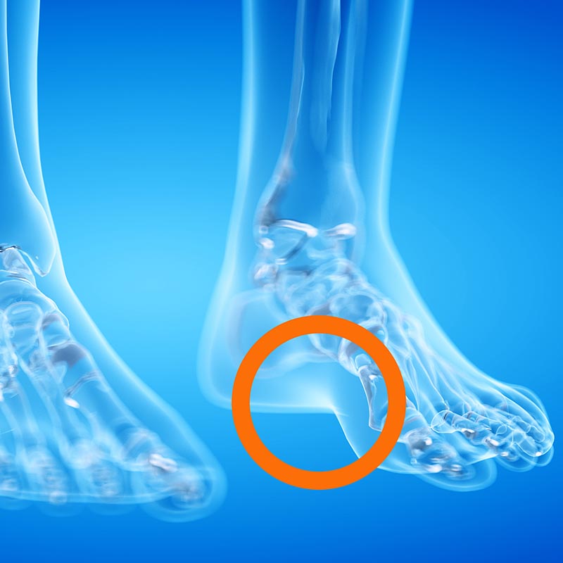Arch Support Shoe Insoles | Trimax Sports Inc.